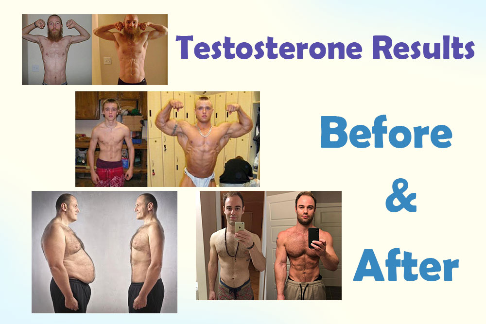 Treatment of Low Testosterone Before and After Results